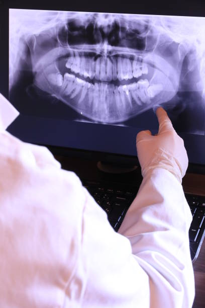 Best Emergency Tooth Extraction in Homeacre Lyndora, PA